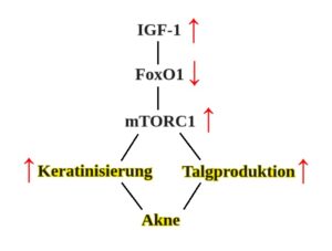 Beziehung zwischen IGF-1 und Akne