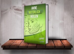 Buch mit Cover von Akne Natürlich Heilen